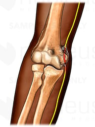 Adhesions to Ulnar Nerve