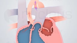Blood Flow Through the Fetal Heart