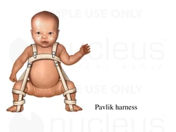 Pavlik Harness