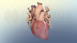 Coronary Artery Disease (CAD)