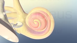 Sensorineural Hearing Loss