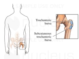 The Trochanteric Bursa