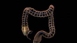Large Intestine with Endoscope Highlighting the Cecum
