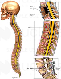 Future Multilevel Surgeries to the Cervical, Thoracic and Lumbar Spine