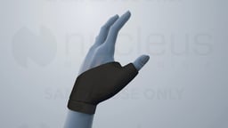 Nonsurgical Treatments for Osteoarthritis of the Thumb