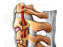 Cervical Vertebrae with Vertebral Artery, Lateral View