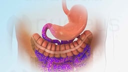 Treating High Blood Sugar