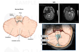 Brain MRI (Axial Sections)