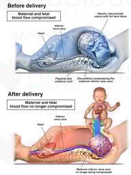 Maternal-Fetal Circulation Before and After Delivery