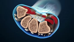 Cross-Sectional Anatomy of the Carpal Tunnel in the Wrist