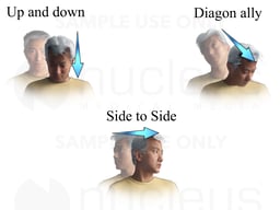 Exercises for Vertigo: Head Movements