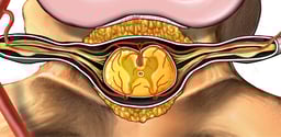 Cross Section of Spinal Cord and Nerves
