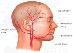 Arteries of the Head