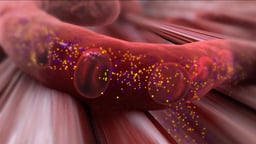 Understanding Type 2 Diabetes