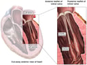 Normal Anatomy of the Mitral (Bicuspid) Valve of the Heart