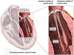 Normal Anatomy of the Mitral (Bicuspid) Valve of the Heart