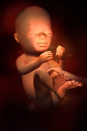 Week 21 in Fetal Development - Lanugo Present