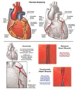 Heart with Abnormal Intramuscular Coronary Artery