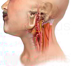 Anatomy of the Neck - Carotid endarterectomy (CEA)