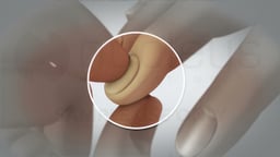 Circulation Checks: Upper Extremity