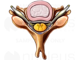 Cervical Vertebra with Spinal Cord, Superior View