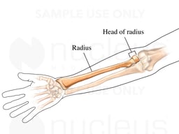 The Head of the Radius