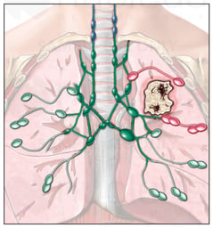 Regional Lymph Nodes of the Thorax