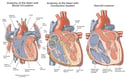 Anatomy of the Heart with Sarcoid Lesions