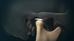 Temporomandibular Joint (TMJ) with Articular Disc