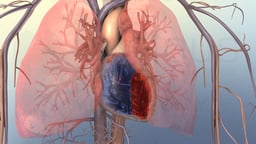 Right-Sided Heart Failure
