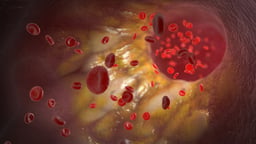 Common Causes of Heart Failure