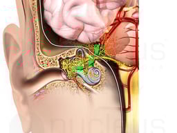 Coronal Ear and Brain Anatomy with Spread of Bacterial Meningitis