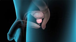 What is Benign Prostatic Hyperplasia (BPH)? 