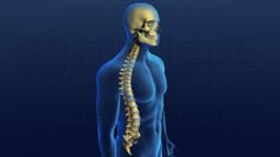 Spinal Cord Injury During Cervial Fusion