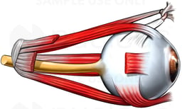Eyeball with Musculature, Lateral View