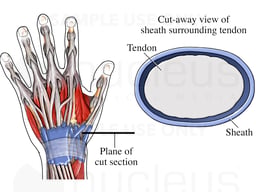 Normal Wrist Tendons and Sheaths