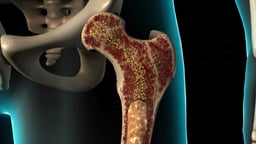 Cross-Sectional Anatomy of the Proximal Femur and Bone Marrow