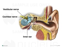 The Vestibular Nerve