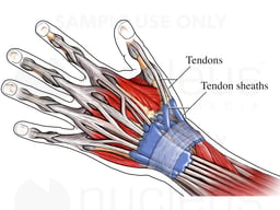 Tendon Sheaths in the Wrist