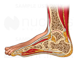Lateral Cut-away View of Foot and Ankle
