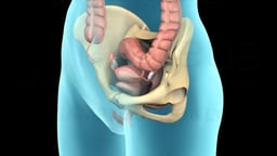 Pelvic Prolapse