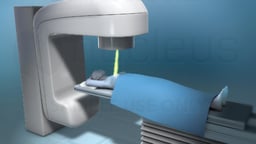 Treatment Options for Breast Cancer