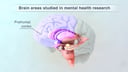 Brain Region Involved in Mental Health Research - Prefrontal Cortex (Labeled)