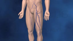 Deep Vein (Venous) Thrombosis (DVT) and Pulmonary Embolism (PE)