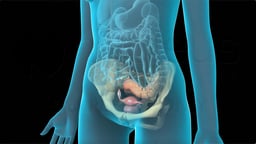 What is a Diagnostic Pelvic Laparoscopy?