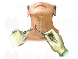 Neck Incision – Older Female