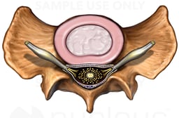 Sacrum with Intervertebral Disc and Nerves, Superior View