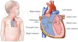 Pediatric Heart