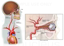 Blood Supply to the Eye and Optic Nerve