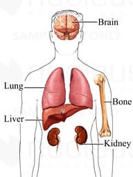 Examples of Structures Visible on a CT Scan